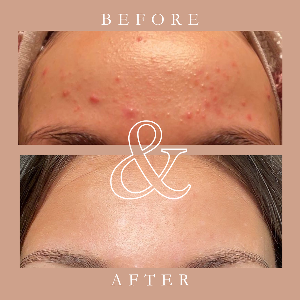 NeuroLift™ Peptide Serum Multi-Peptide + Copper Complex for Smoother, Firmer Skin